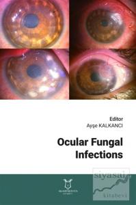 Ocular Fungal Infections