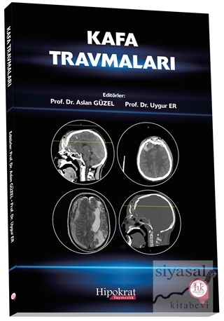 Kafa Travmaları
