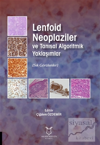 Lenfoid Neoplaziler ve Tanısal Algoritmik Yaklaşımlar Kolektif
