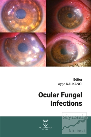 Ocular Fungal Infections Ayşe Kalkancı