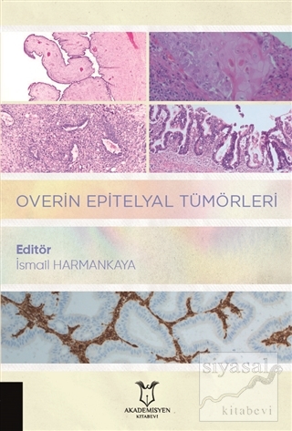 Overin Epitelyal Tümörleri